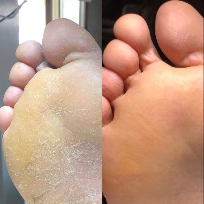 Beauté des pieds 2J